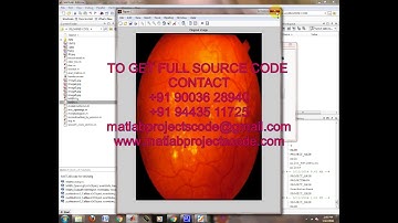 Segmentation of Blood Vessels and Optic Disc in Retinal Images