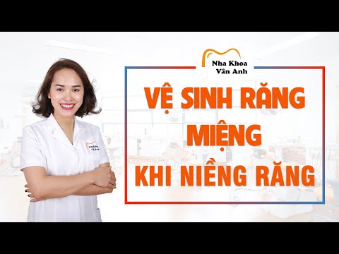 vệ sinh khi niềng răng tại Kemtrinam.vn