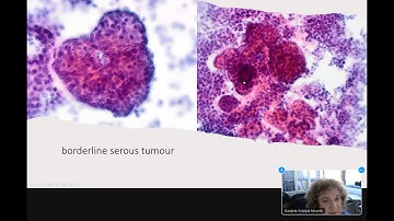 BAC Spring Tutorial 18th March 2023