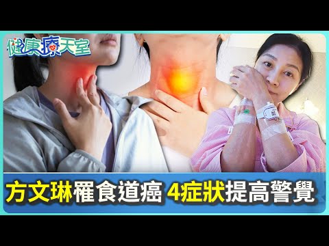 【健康療天室】方文琳罹食道癌自曝愛喝高粱 醫揭「危險因子」4症狀提高警覺 @ChinaTimes