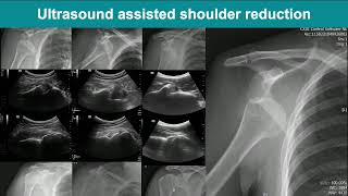 20260313 Procedures-Basic - Part 1