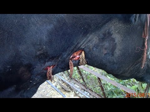 Хлористый кальций 10 и флегмонозный паратромбофлебит.