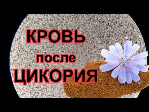 Кровь после цикория