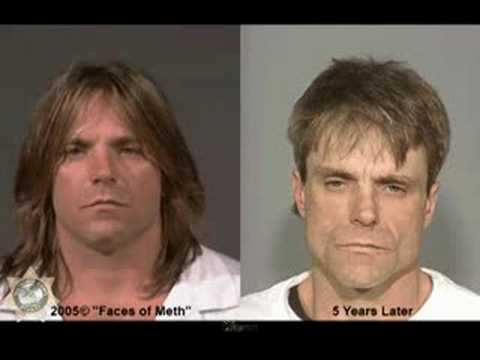 crystal meth before and after mug shots