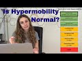 hEDS, HSD, Hypermobility differences | Is HYPERMOBILITY NORMAL?