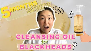 Cleansing Oil for Blackheads | 5 Months Honest Review Cleansing Oil Effective in Clearing Blackheads