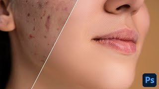 How to RETOUCH SKIN like a PRO in Photoshop 2022  Easy Tips !!