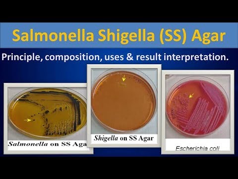 Salmonella shigella (SS) Agar.