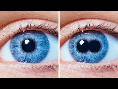 ひとつの眼球に二つの瞳孔がある重瞳、他、人体の変わった特徴