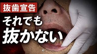 インプラント回避できるのか?重度歯周病のリアルな治療全記録