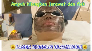 Nyobain Laser Korean BlackDoll ! Before Afternya WOW Hempas Jerawat !