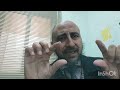ادويه منع الرفض بعد زراعه الكلي البروجراف Immunosuppression Medication Prograf 