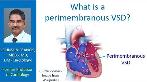 What is a perimembranous VSD?