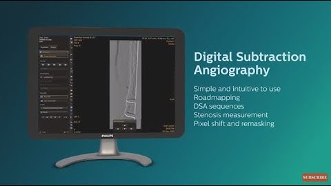 Philips Digital Subtraction Angiography (DSA) fluoroscopy solution animation video
