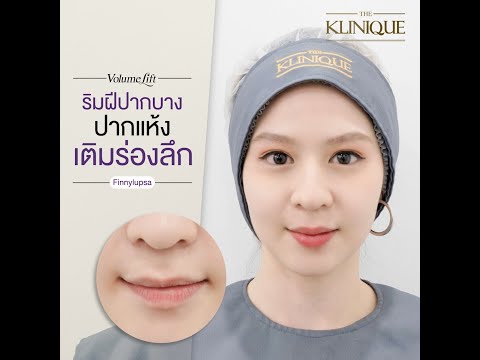 ริมฝีปากบาง ปากแห้ง เติมร่องปาก ด้วยโปรแกรม VolumeLife ฟิลเลอร์ปาก