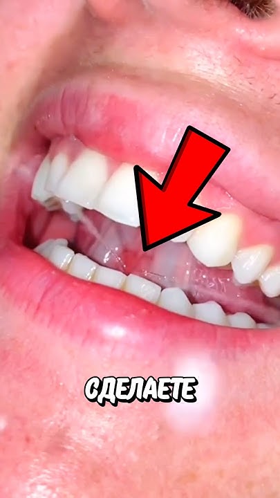 Как Стрелять Слюной Изо Рта? 🤯 - YouTube