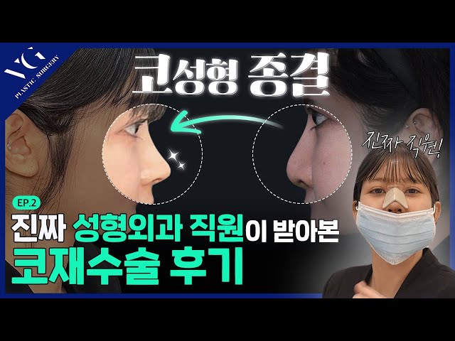 코재수술 하고 윈터 된 썰✨ 푼다ㅣ성형외과 직원이 받아본 코성형. EP2