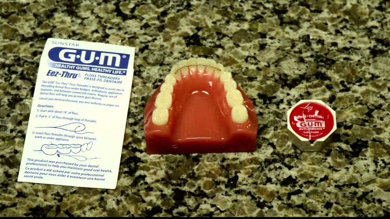 Tru North Orthodontics - Retainer - HD