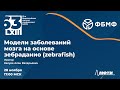 63-я Конференция МФТИ. Модели заболеваний мозга на основе зебраданио (zebrafish)