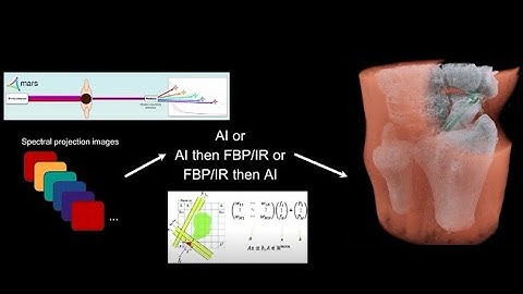 Artificial intelligence in spectral photon-counting CT image reconstruction