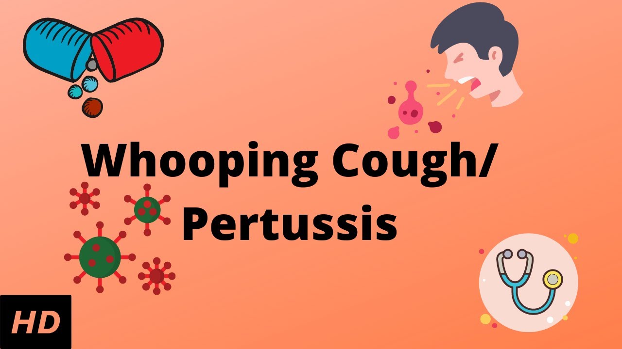 Whooping cough/Pertussis, Causes, Signs and Symptoms, Diagnosis and