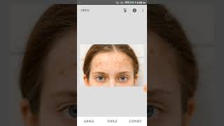 FASTEST WAY TO REMOVE SCAR WITH SNAP SEED APP screenshot 4