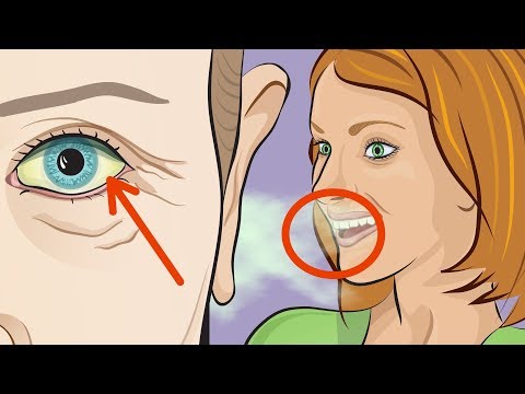 Video: Quando Un Mal Di Freddo Smette Di Essere Contagioso? Suggerimenti Per La Prevenzione