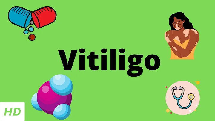 Vitiligo, Causes, Signs and Symptoms, Diagnosis and Treatment. - DayDayNews