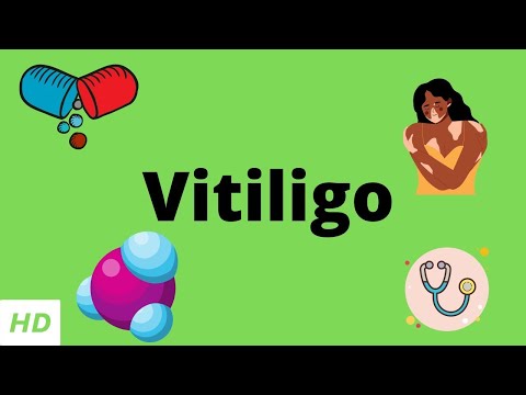 Video: Hoe vitiligo te diagnosticeren 14 stappen (met afbeeldingen)