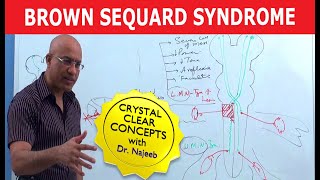 Brown Sequard Syndrome | Internal Medicine 💊