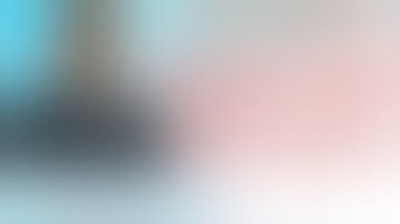 Migrated metal stent with perforation of stomach | Stent migration | Dr Keyur Bhatt