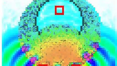 3D FDTD simulation of phantom