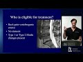 Treatment of Low Back Pain with Basivertebral Nerve Ablation - Douglas P. Beall, MD