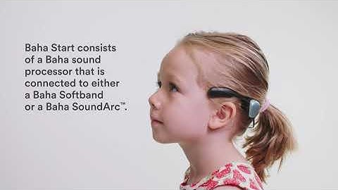 How Cochlear™ Baha® Start works