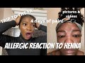 I HAD A REAL ALLERGIC REACTON | HOW TO PATCH TEST| MINA BROW HENNA (with photos and videos)