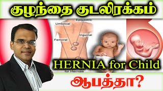 Hernia for child baby scrotal swelling surgery doctor laparoscopy குடலிறக்கம் குழந்தை உடுமலை