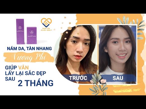 Vương Phi Trị Nám Tàn Nhang Tốt Không? Chuyên Gia Đánh Giá Chi Tiết