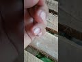 nyamuk jenis apa ini