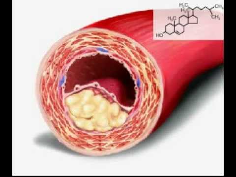 Video: Cila është Më E Shëndetshme: Gjalpi Ose Margarina?