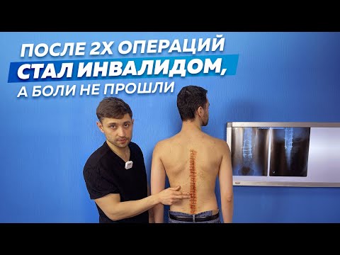 2 Операции на