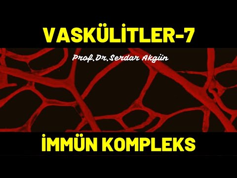 Vaskülitler, 7,  Immun Kompleks Vaskülitler, Romatoloji,  Tıp Dersleri, Serdar Akgün