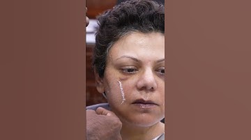 Look younger from plastic surgery