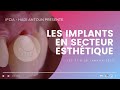 Ifcia hadi antoun  session sur les implants en secteur esthtique et ses diffrentes techniques