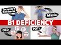 Bizarre Symptoms of Vitamin B1 Deficiency That You