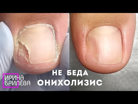 Видео: Как остановить шелушение кутикулы: 15 шагов (с иллюстрациями)