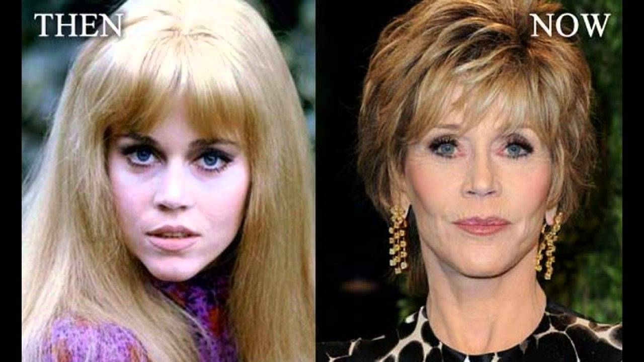 Jane Fonda Plastic Surgery Before and After - YouTube