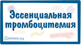 Эссенциальная тромбоцитемия — причины, симптомы, патогенез, диагностика, лечение