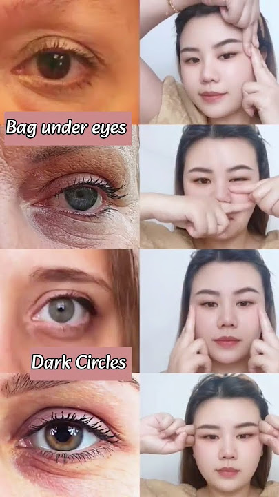 Anti-aging Facial Yoga for Reducing Dark Circles, Bags under eyes #faceyoga #eyeyoga #exercise #fyp