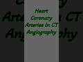 Heart Coronary Arteries in CT Angiography.
