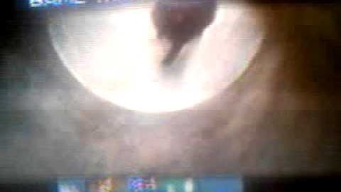 Setup infected mw3 split screen killcam